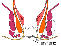 肠道水疗